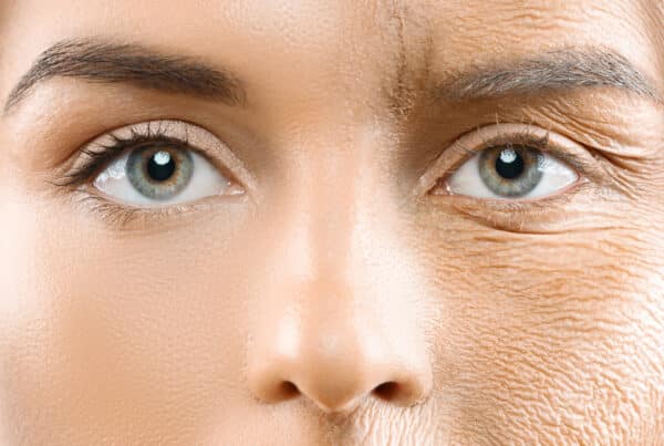 close-up picture of woman's face depicting aging young on left side old and wrinkled on right side