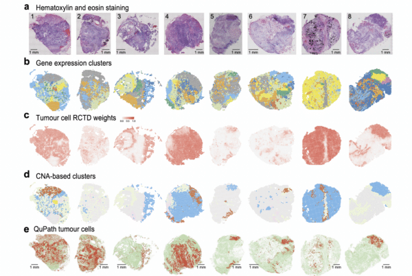 image shows ovarian cancer cells from various patients in various colours to show tumour elements